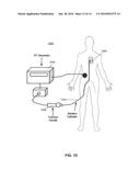 SYSTEM AND METHOD FOR CARDIAC ABLATION diagram and image