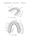 Assemblies For Improved Periodontal Surgery And Recovery Therefrom diagram and image