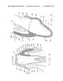 Assemblies For Improved Periodontal Surgery And Recovery Therefrom diagram and image