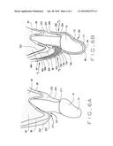 Assemblies For Improved Periodontal Surgery And Recovery Therefrom diagram and image