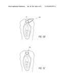 SYSTEMS AND METHODS FOR TREATING FEMALE INCONTINENCE AND PELVIC NERVE     DYSFUNCTION diagram and image