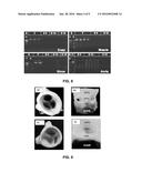 Decellularization Method and System and Decellularized Tissue Formed     Thereby diagram and image