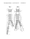 LOCKING MECHANISM FOR SECURING THE INTERFACE BETWEEN STENT GRAFTS diagram and image