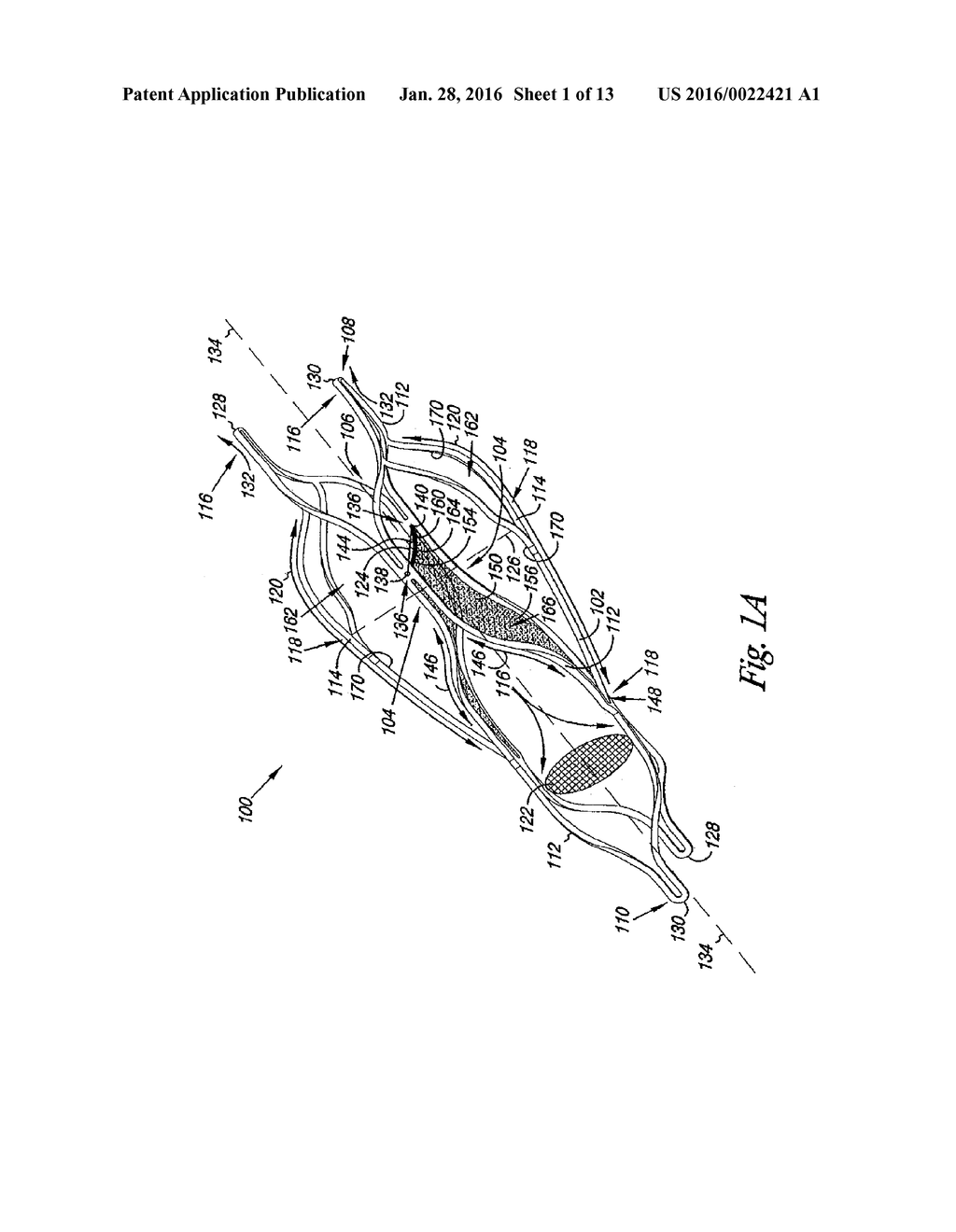 VENOUS VALVE, SYSTEM, AND METHOD WITH SINUS POCKET - diagram, schematic, and image 02