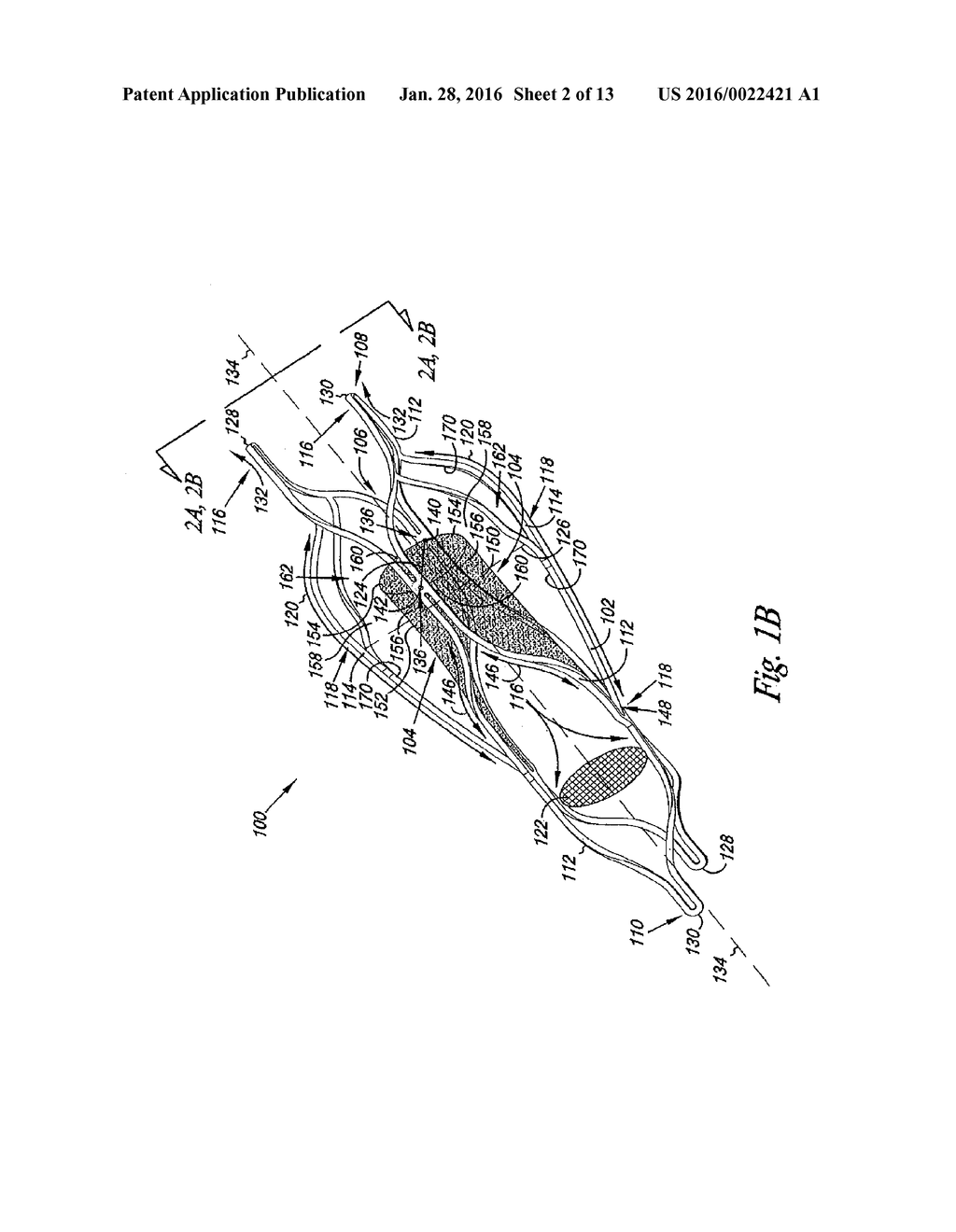 VENOUS VALVE, SYSTEM, AND METHOD WITH SINUS POCKET - diagram, schematic, and image 03