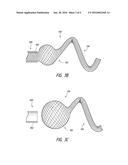 Occlusive Device diagram and image