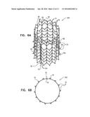 STENT WITH TETHER INTERFACE diagram and image