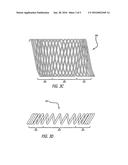 TRACHEOBRONCHIAL IMPLANTABLE MEDICAL DEVICE AND METHODS OF USE diagram and image