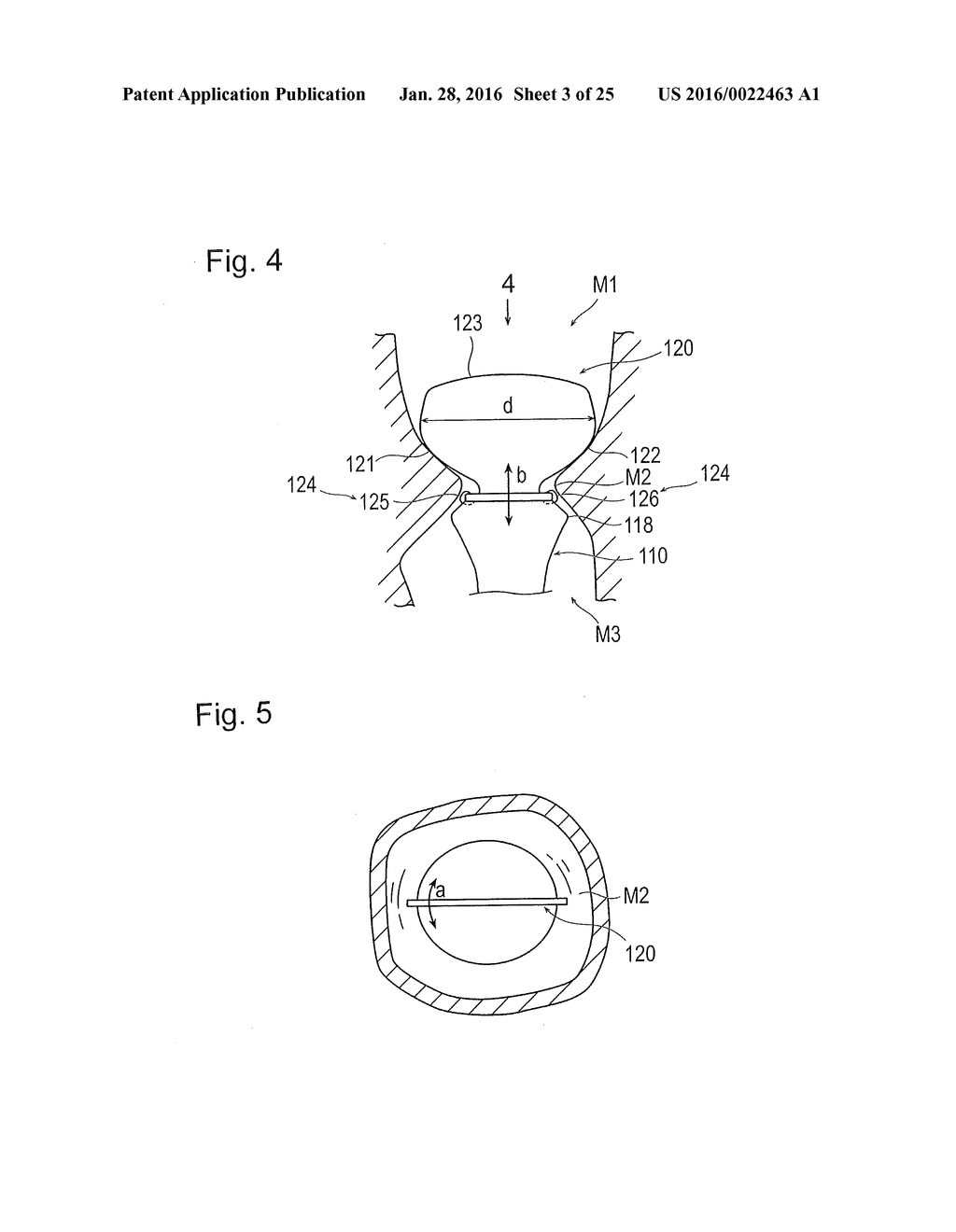 DIGESTIVE TRACT DEVICE - diagram, schematic, and image 04