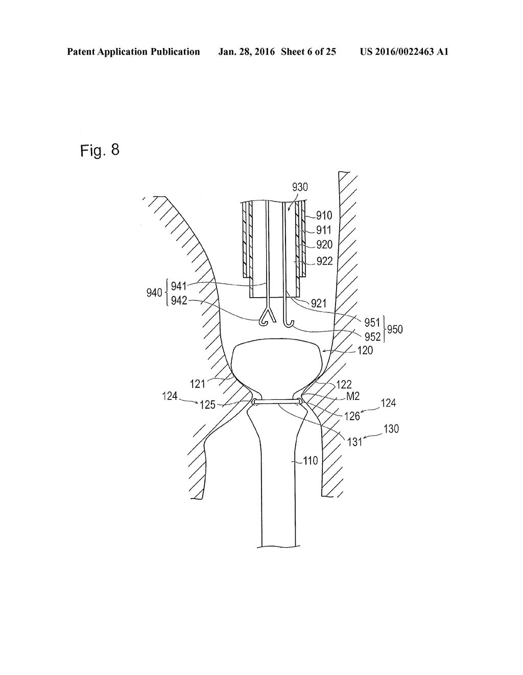 DIGESTIVE TRACT DEVICE - diagram, schematic, and image 07