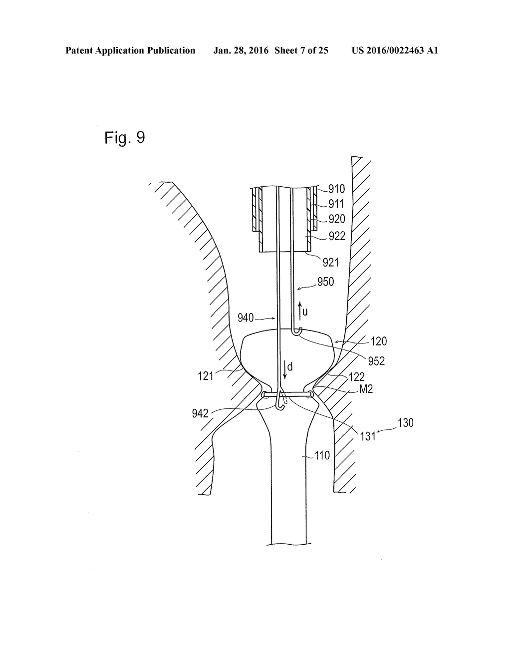 DIGESTIVE TRACT DEVICE - diagram, schematic, and image 08