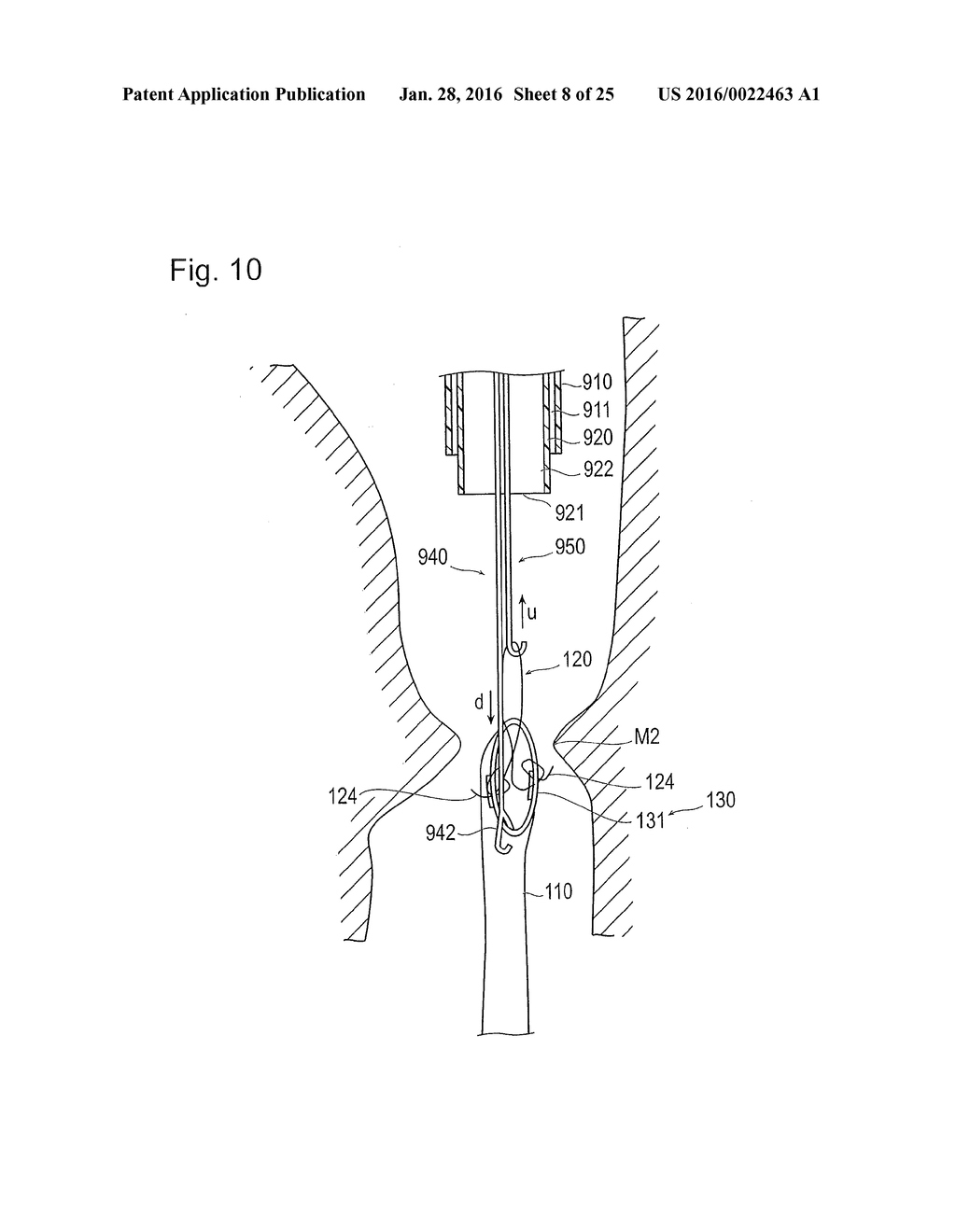 DIGESTIVE TRACT DEVICE - diagram, schematic, and image 09