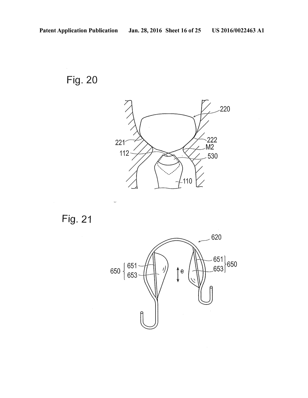 DIGESTIVE TRACT DEVICE - diagram, schematic, and image 17