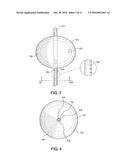 Balloon Immobilization Device for Radiation Treatment diagram and image