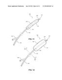 Balloon Immobilization Device for Radiation Treatment diagram and image