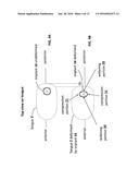 TONGUE DEFORMATION IMPLANT diagram and image