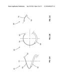 TONGUE DEFORMATION IMPLANT diagram and image