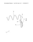 TONGUE DEFORMATION IMPLANT diagram and image