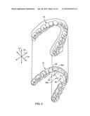 DENTAL APPLIANCE FOR TREATMENT OF SLEEP APNEA diagram and image