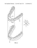 DENTAL APPLIANCE FOR TREATMENT OF SLEEP APNEA diagram and image