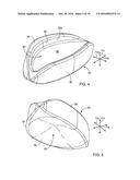 DENTAL APPLIANCE FOR TREATMENT OF SLEEP APNEA diagram and image