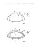 DENTAL APPLIANCE FOR TREATMENT OF SLEEP APNEA diagram and image