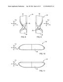 DENTAL APPLIANCE FOR TREATMENT OF SLEEP APNEA diagram and image