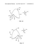 DENTAL APPLIANCE FOR TREATMENT OF SLEEP APNEA diagram and image