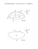 DENTAL APPLIANCE FOR TREATMENT OF SLEEP APNEA diagram and image