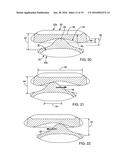 DENTAL APPLIANCE FOR TREATMENT OF SLEEP APNEA diagram and image