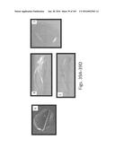 Stable Silk Protein Fragment Compositions diagram and image