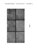 TREATMENT OF NEURODEGENERATIVE DISEASES, CAUSATION OF MEMORY ENHANCEMENT,     AND ASSAY FOR SCREENING COMPOUNDS FOR SUCH diagram and image