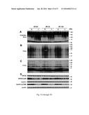 O-GLCNACYLATION TREATMENT FOR ISCHEMIC BRAIN INJURY diagram and image