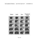 O-GLCNACYLATION TREATMENT FOR ISCHEMIC BRAIN INJURY diagram and image