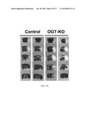 O-GLCNACYLATION TREATMENT FOR ISCHEMIC BRAIN INJURY diagram and image