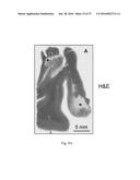 O-GLCNACYLATION TREATMENT FOR ISCHEMIC BRAIN INJURY diagram and image