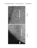 Minced Cartilage Systems and Methods diagram and image