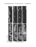 THERAPEUTIC METHODS FOR TREATING SOLID TUMORS AND RELATED DIAGNOSTIC     METHODS diagram and image