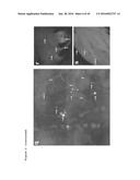 THERAPEUTIC METHODS FOR TREATING SOLID TUMORS AND RELATED DIAGNOSTIC     METHODS diagram and image