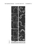 THERAPEUTIC METHODS FOR TREATING SOLID TUMORS AND RELATED DIAGNOSTIC     METHODS diagram and image