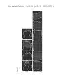 THERAPEUTIC METHODS FOR TREATING SOLID TUMORS AND RELATED DIAGNOSTIC     METHODS diagram and image