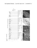 THERAPEUTIC METHODS FOR TREATING SOLID TUMORS AND RELATED DIAGNOSTIC     METHODS diagram and image