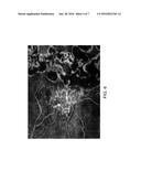 COMPOSTIONS AND METHODS FOR TREATING RETINAL DISEASE diagram and image