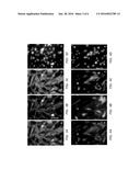 INDIVIDUALIZED HIGH PURITY COLON CARCINOMA STEM CELLS, METHODS AND USE OF     THE SAME diagram and image