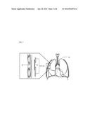 METHOD OF TREATING PLEURAL ABNORMALITY diagram and image