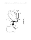 CATHETER MOUNT WITH SUCTION PORT diagram and image