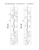 SUPPORTIVE BALLOON CATHETER diagram and image