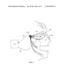 STIMULATION PATTERNS FOR TREATING DRY EYE diagram and image