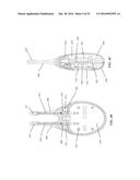 STIMULATION PATTERNS FOR TREATING DRY EYE diagram and image