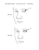 STIMULATION PATTERNS FOR TREATING DRY EYE diagram and image